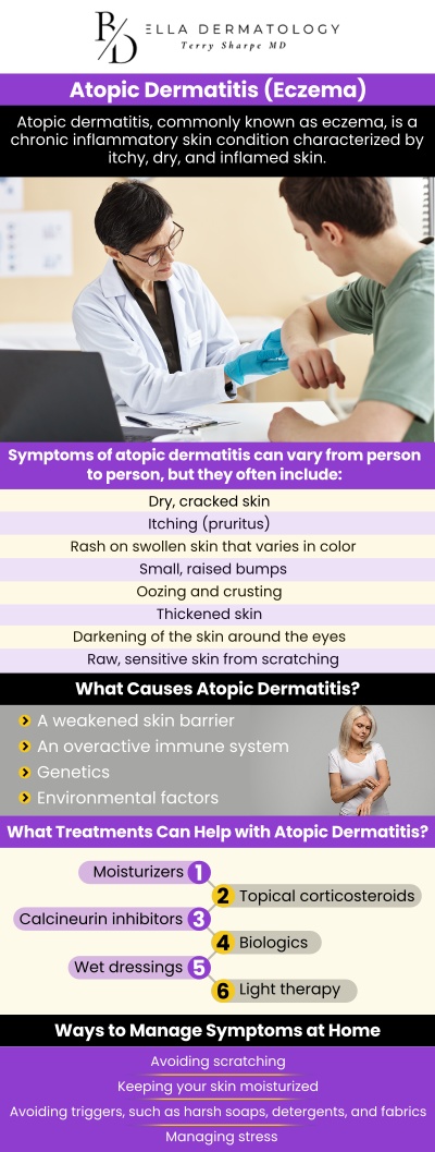 Eczema can be a frustrating condition, with constant trial and error to find the right treatment. It causes inflamed, dry patches on the skin that lead to discomfort and irritation. While a perfect solution may not exist, with patience and the right approach, many people can manage their symptoms effectively. Visit Dr. Terry L. Sharpe, MD, for personalized treatment options to manage your eczema symptoms effectively. For more information, contact us or request an appointment online. We are conveniently located at 2340 Patrick Henry Parkway Suite 150, McDonough, GA 30253.