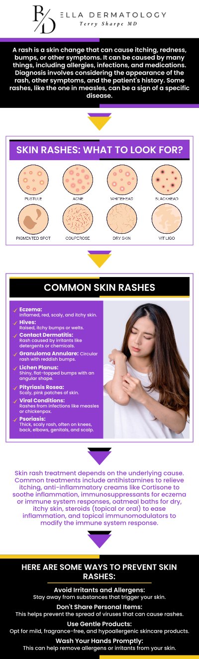 At Bella Dermatology, we specialize in diagnosing and treating a variety of skin rashes, including eczema, psoriasis, and allergic reactions. Our experienced team provides personalized care to identify the underlying causes and offer effective treatments that help soothe irritation, reduce inflammation, and promote healing, ensuring your skin returns to its healthiest state. For more information, contact us or schedule an appointment online. We are conveniently located at 2340 Patrick Henry Pkwy Suite 150, McDonough, GA 30253.