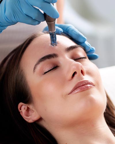Microneedling in McDonough, GA
