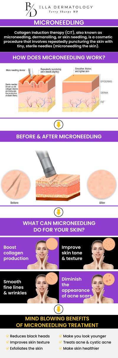 If you are looking for a way to revitalize your complexion without the downtime of invasive surgery, professional collagen induction therapy may be the answer. At Bella Dermatology, we utilize medical-grade technology to trigger your body’s natural healing powers, smoothing away imperfections from the inside out. Led by Dr. Terry Sharpe, MD, our clinic provides a sterile, clinical environment where your skin’s health and safety are the top priorities. Whether you are battling the lingering marks of past acne or the fine lines of time, our customized microneedling treatments offer a proven path to a firmer, more radiant glow. For more information, contact us or request an appointment online. We are conveniently located at 2340 Patrick Henry Parkway Suite 150, McDonough, GA 30253.