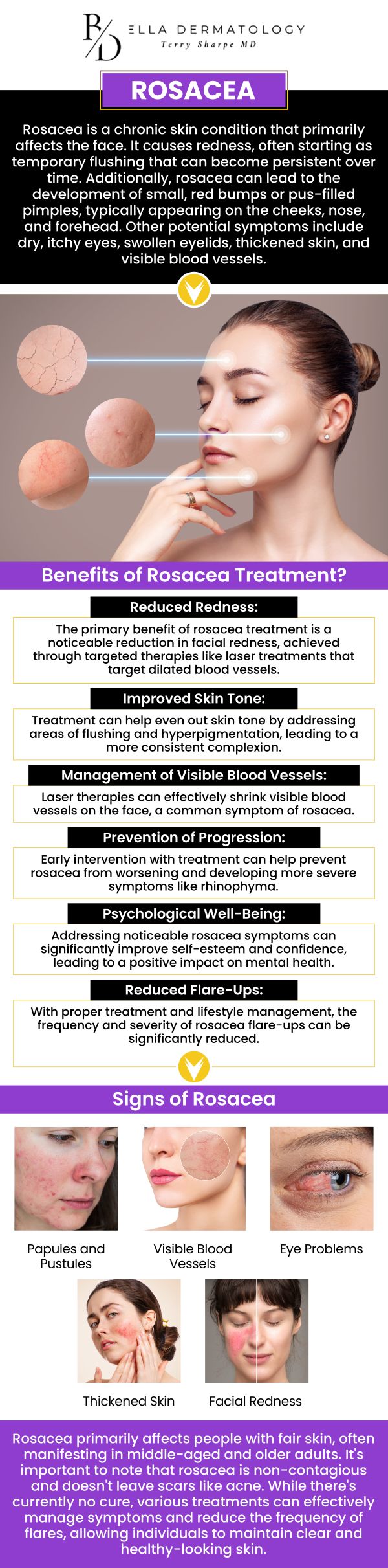 Common questions asked by patients: What causes rosacea and how can it be managed? What are the common symptoms of rosacea? How is rosacea diagnosed by a dermatologist? Is rosacea a lifelong condition or can it be cured? For more information, contact us or schedule an appointment online. We are conveniently located at 2340 Patrick Henry Pkwy Suite 150, McDonough, GA 30253. We serve patients from McDonough GA, Flippen GA, Stockbridge GA, Lovejoy GA, Hampton GA, Locust Grove GA, and surrounding cities.