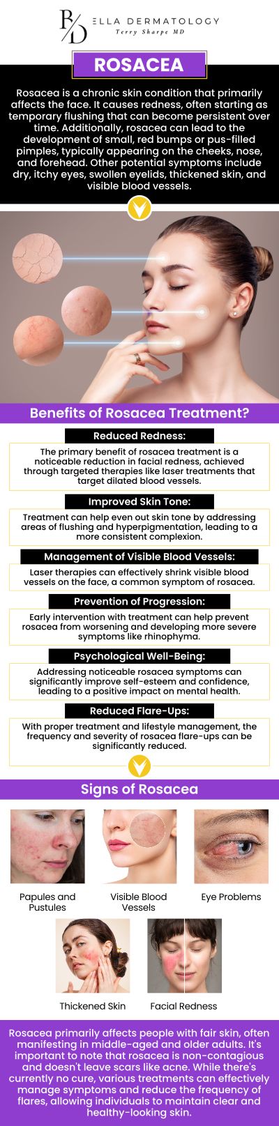 Common questions asked by patients: What causes rosacea and how can it be managed? What are the common symptoms of rosacea? How is rosacea diagnosed by a dermatologist? Is rosacea a lifelong condition or can it be cured? For more information, contact us or schedule an appointment online. We are conveniently located at 2340 Patrick Henry Pkwy Suite 150, McDonough, GA 30253. We serve patients from McDonough GA, Flippen GA, Stockbridge GA, Lovejoy GA, Hampton GA, Locust Grove GA, and surrounding cities.