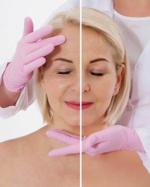 Dermatological Surgery in McDonough, GA