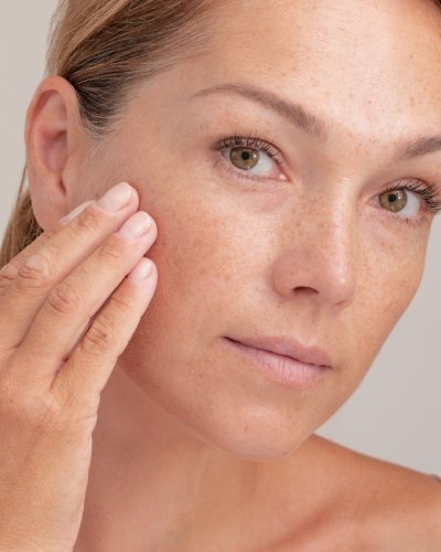 Melanoma Treatment in McDonough, GA